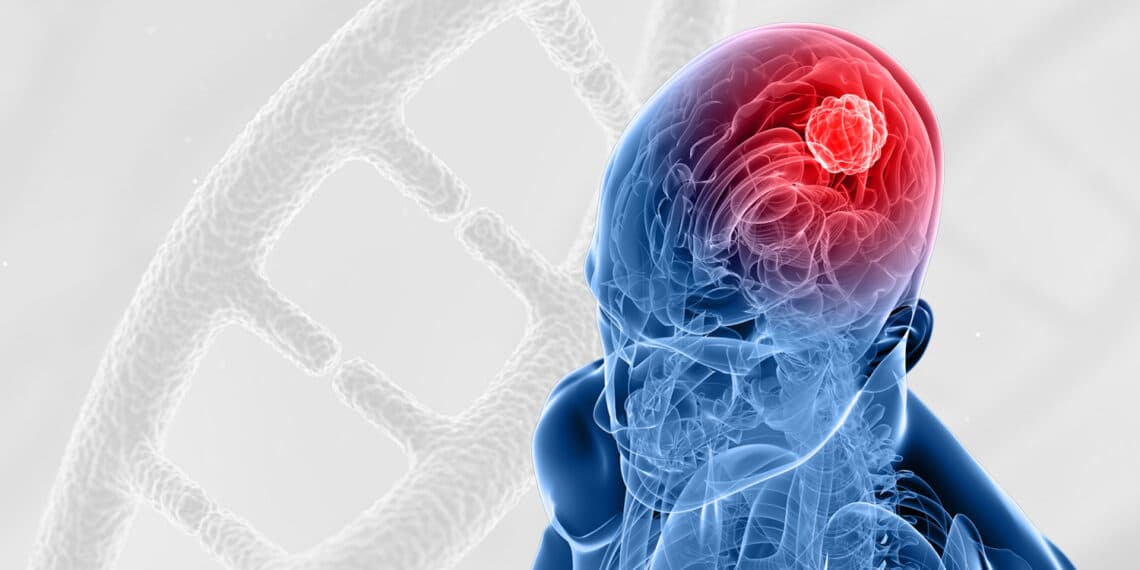 Glioblastoma_tumour_sequencing