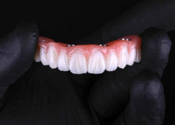 Flexcera Smile Ultra+ dental resin