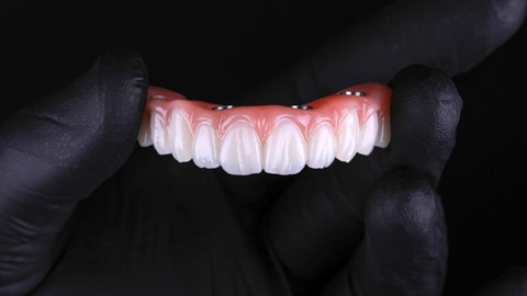 Flexcera Smile Ultra+ dental resin
