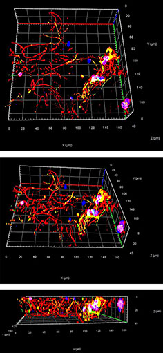 Motor neuron Uppsala University